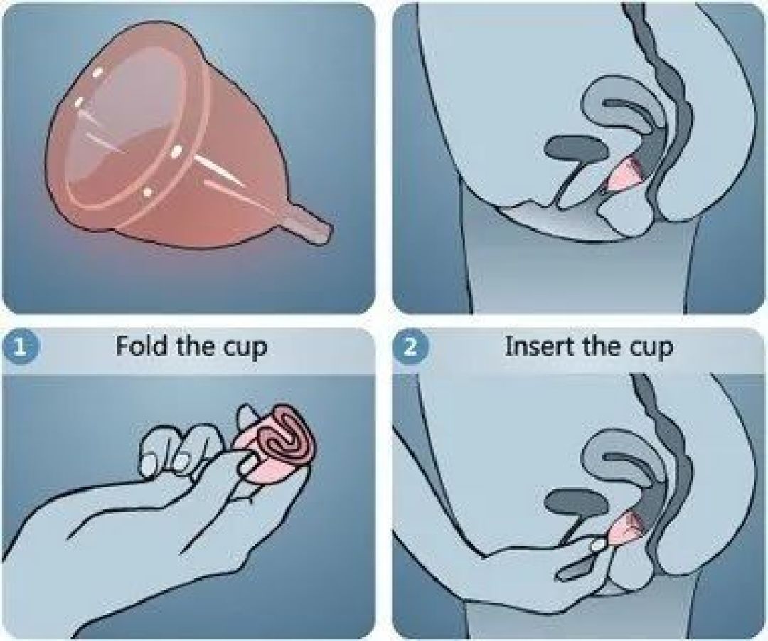 火热聊天中姨妈来了卫生棉条月经杯卫生巾你用什么来招待