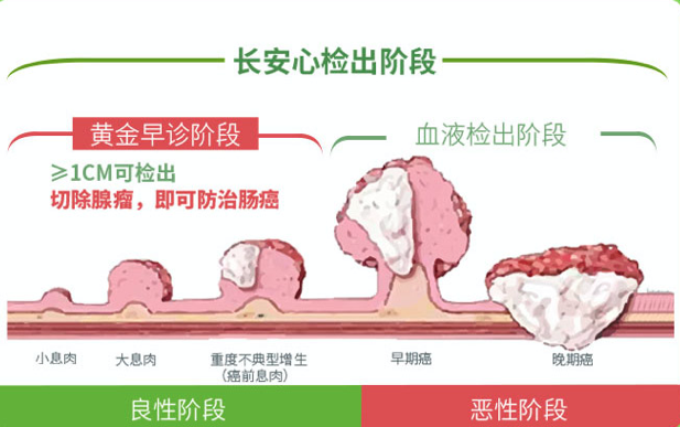 便秘、腹泻……各种“带薪拉屎”症状看过来，新技术解你“后”顾之忧