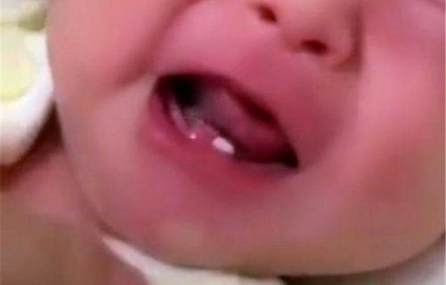 宝宝出牙晚，长牙慢，是不是缺钙了？一篇消除你关于宝宝出牙的所有焦虑