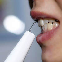 智趣测评 篇二百七十一：电动牙刷做不到的事它可以！素诺智能可视超声波洁牙仪T11Pro测评