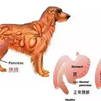 胰腺炎要低脂？到底多少才算低？