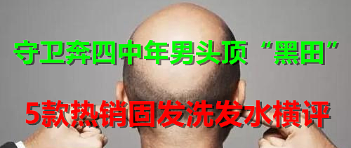 ​2022年，防脱去屑洗发水怎么选？ 这些收藏过千的10篇好文，从头发护理经验到产品横评体验，点进来竟然还想收藏一遍！