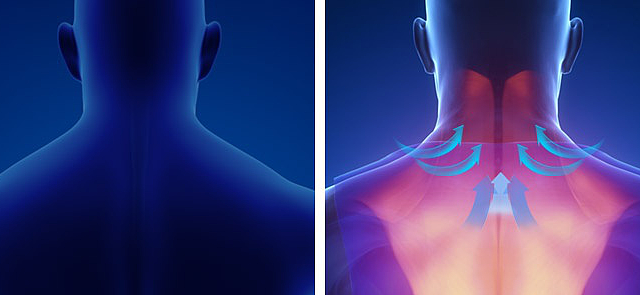 科普篇：颈椎按摩器肉测指南