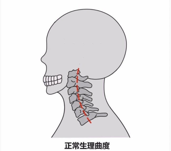 299元众筹的乐伽AI智能枕，竟然可以边睡边拉伸？