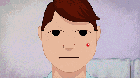 为了祛痘，我经历了针清、照光、吃药……来聊聊我的「硬核」祛痘史！