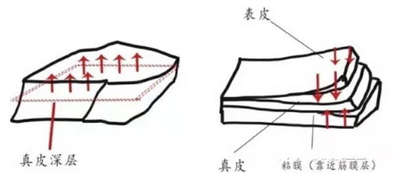 科普一个抗衰新项目，号称平价热玛吉的Fotona 4D