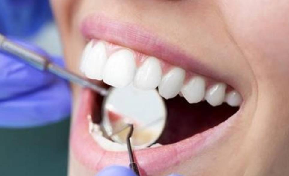 为什么你的牙医总让你洗牙 什么值得买