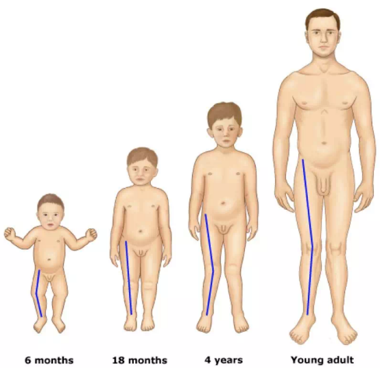 宝宝腿不直跟不绑腿、穿纸尿裤有关系吗？真正的原因是什么？