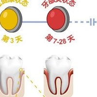 中科院青岛能源所与宝洁公司等合作，首次提出“牙龈亚健康”新概念