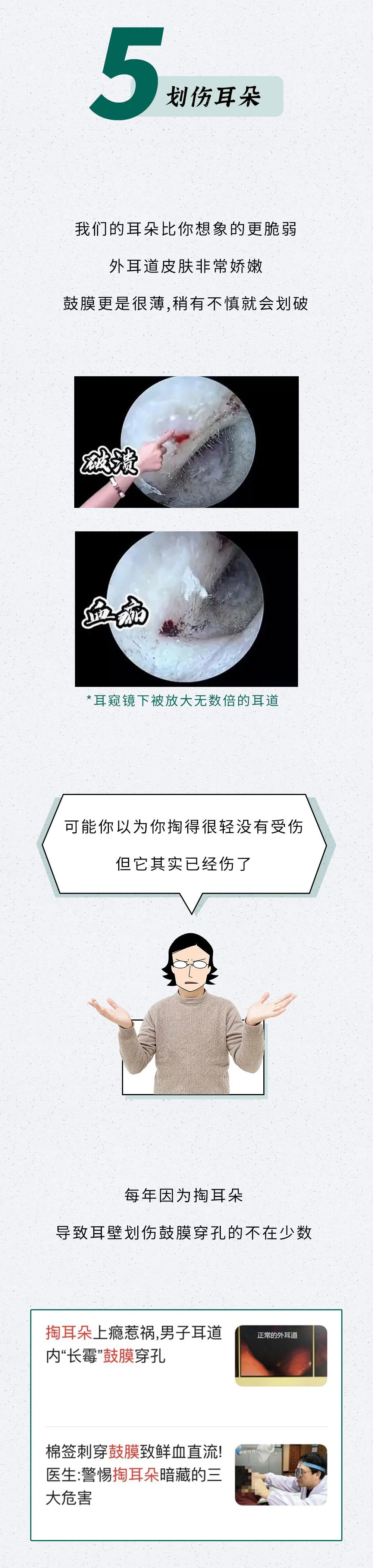 还掏耳屎呢？看看你的耳朵都烂成啥样了！！！