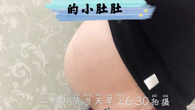 二胎妈妈没有妊娠纹怎么做到的❓ 