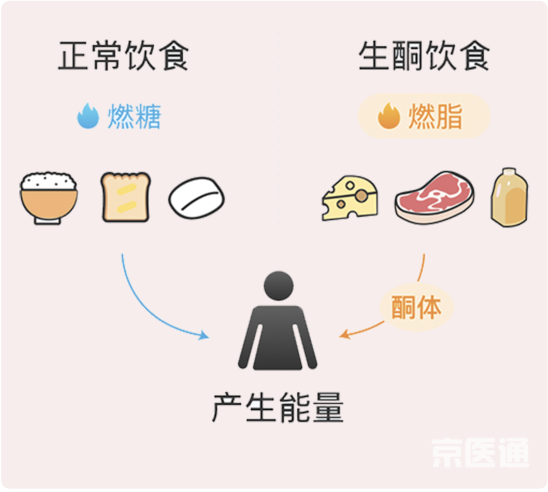 减肥神速的「生酮饮食」靠谱吗？医生：更适合这些人！