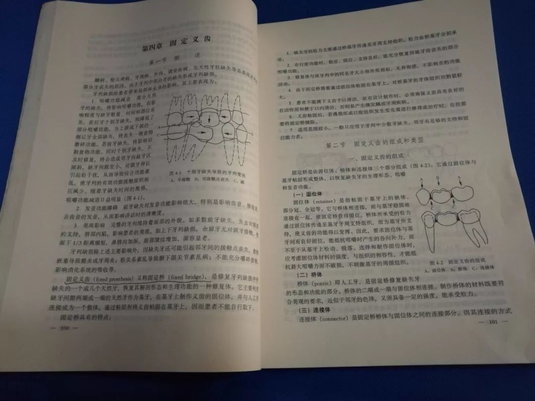 中国人最常见的烤瓷牙，评价褒贬不一，牙医告诉你该做还是不该做？