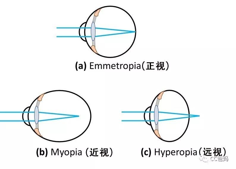 80%以上孩子运动不足！从小运动和不运动，差别竟然这么大~