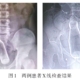 我在急诊室遇到了一个直肠有异物的男人。