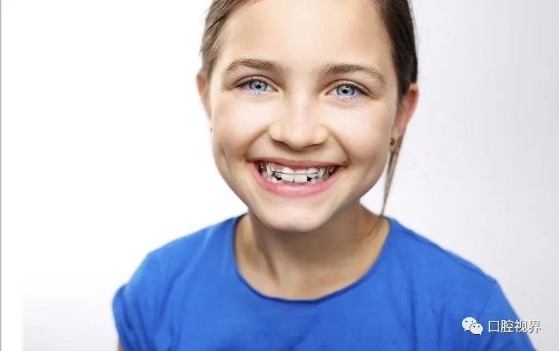 牙齿不齐是基因决定的吗？