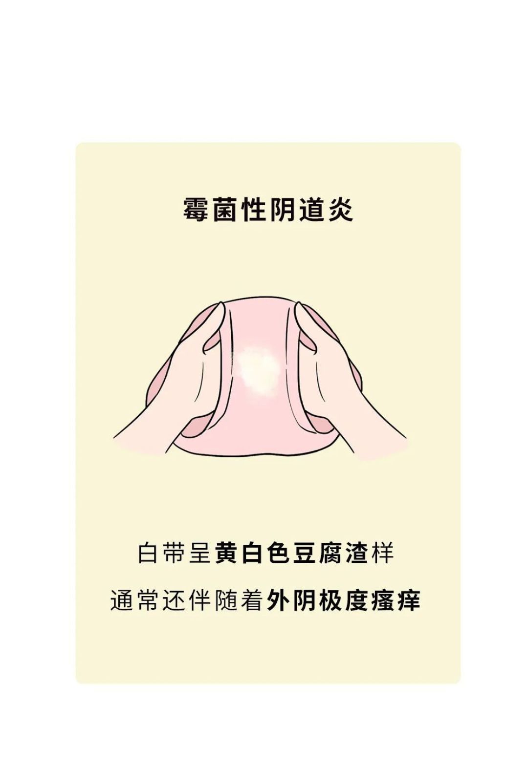 “我没有性生活,却有妇科病。”