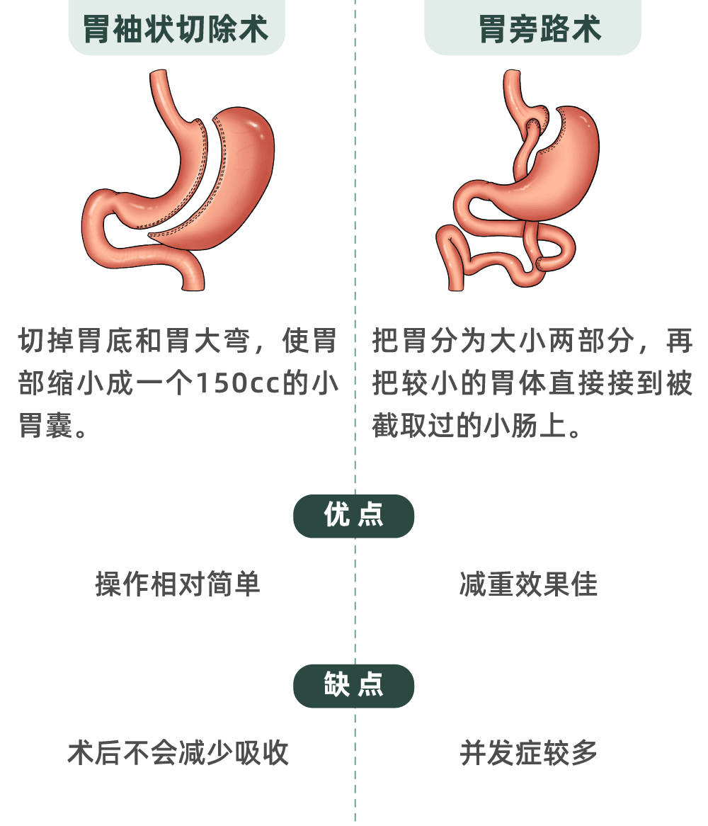 24岁，200斤，切胃减肥后天天吐！