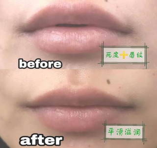 德国·天露芬沙棘润唇膏👄