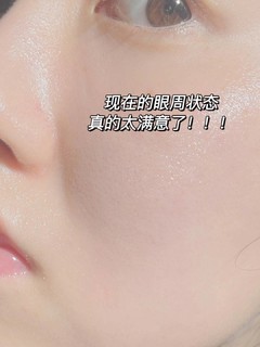 终于把细纹黑眼圈淡化了！