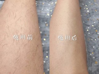 歌岚脱毛仪，让你摆脱毛女孩儿！