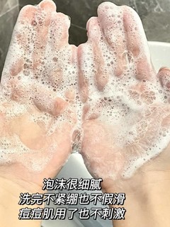 油痘肌男生护肤套装，不做油腻男