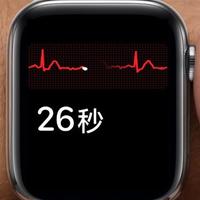  苹果用户狂喜，国行ECG心电图功能推送，Apple Watch开通仅需两步