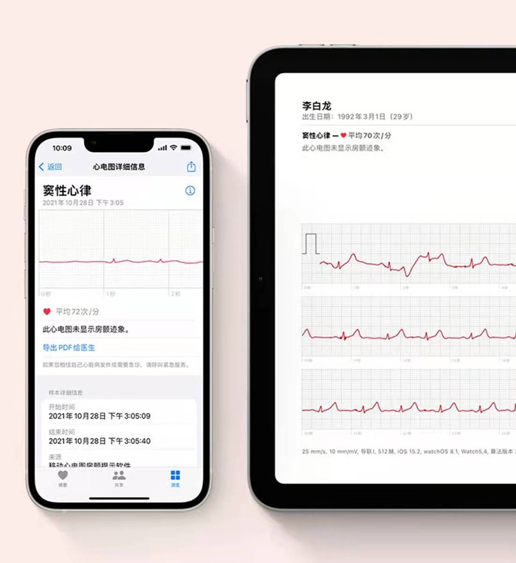 Apple Watch 推出移动心电图房颤提示软件与移动脉率房颤提示软件