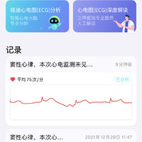手表的ECG搭配这个软件绝了……