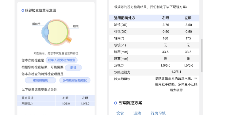 篇一 ： 网上配镜的100条必备干货  | 验光+镜片篇