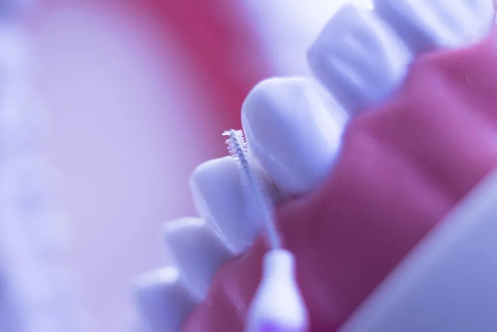 刷牙+牙线+冲牙器每天30分钟，只有把日常战线拉满才能做到“全方位”深层口腔清洁