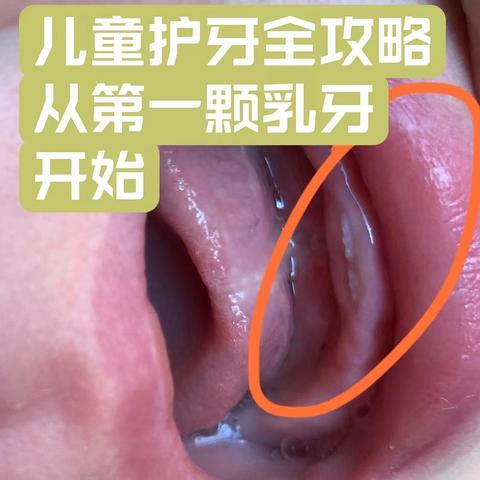 618值得买！预防儿童龋齿，孩子的牙膏和刷牙用品怎么选？