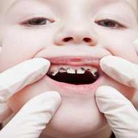 儿童龋齿率超7成，乳牙龋坏要治疗！6招有效防龋，给孩子一口好牙～