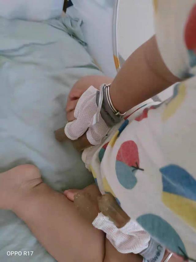 防吃手手套有用吗