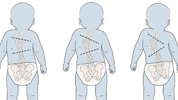 育儿园：抓住脊柱发育黄金期，分享7岁前保护孩子脊柱的3个重点