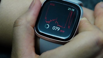 DIDO G28S血糖版智能手表如何做到身体监测面面俱到？