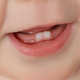 乳牙龋齿危害大，防龋从0～3岁做起，婴幼儿口腔护理深度科普