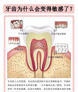 牙齿敏感的因素二