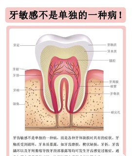 牙齿敏感的因素二