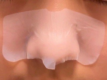 巨好用的RNW鼻贴