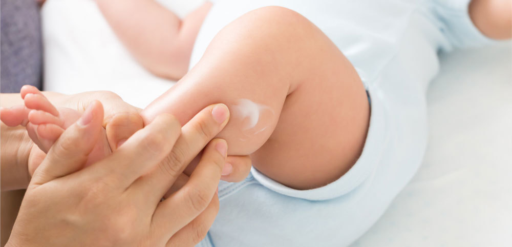 宝宝湿疹反反复复，如何有效护理？从这3点来入手！