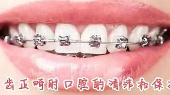 浅谈牙齿正畸时口腔的清洁和保护