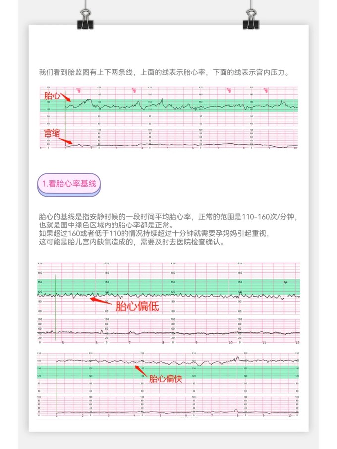 妈妈护理