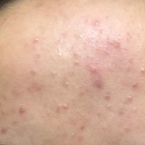 换季肌肤敏感但又想美白？两步搞定！(内附惊喜好价)