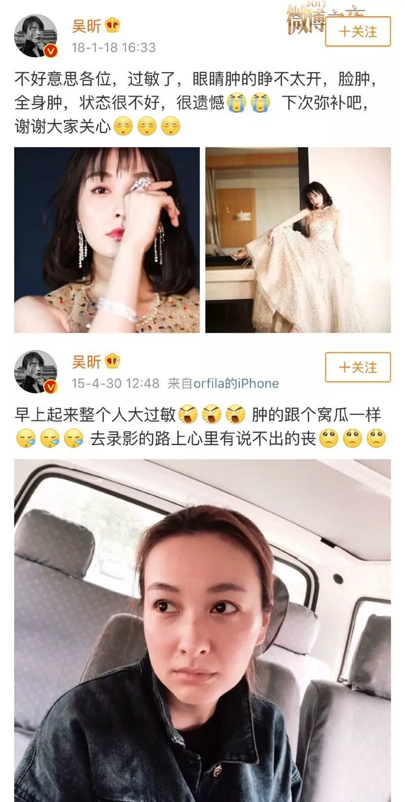 五花八门的过敏反应！春季肌肤又双叒叕“玻璃心”