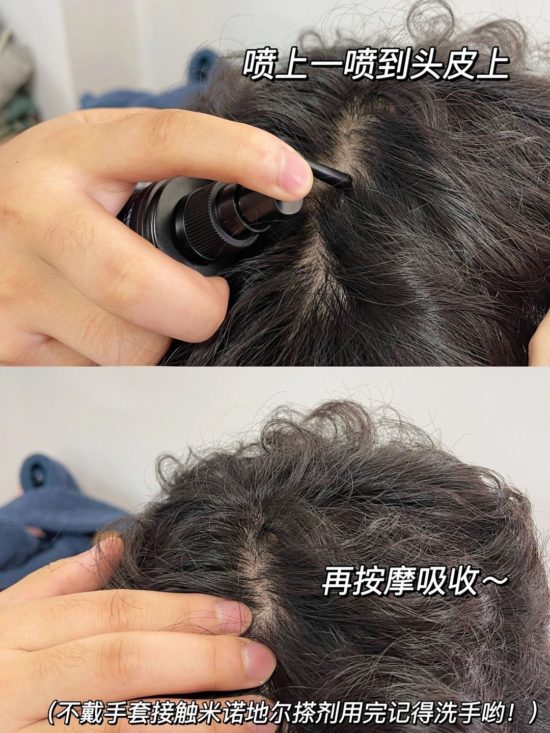 防脱+生发，三个月发量浓密！拯救“秃头”它们是专业的！