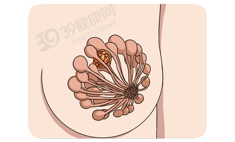 一针“冻死”癌细胞？这种抗癌新疗法可治疗多种肿瘤，费用或只需2万