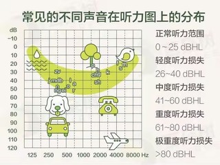 烧到最后还得是助听器