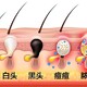 都说缩毛孔只能靠医美 💉对此我的评价是：