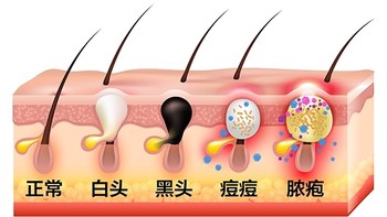 都说缩毛孔只能靠医美 💉对此我的评价是：